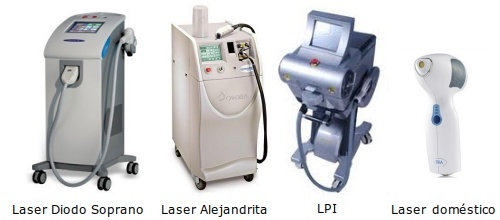 Fotodepilacion laser